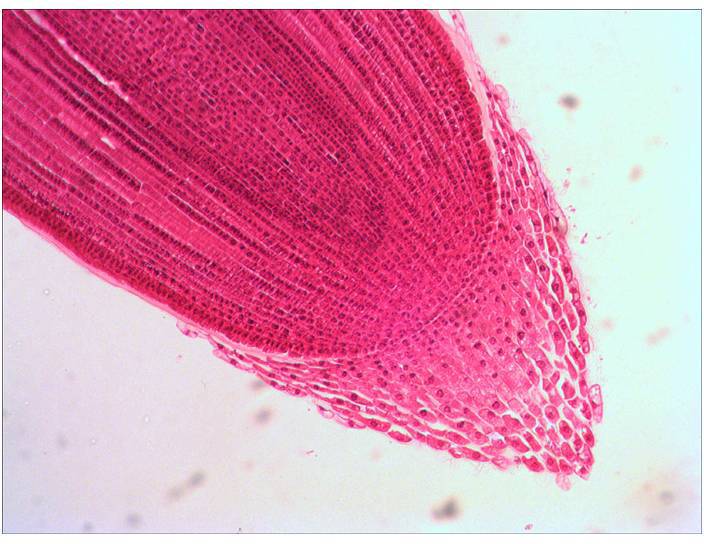 Zbliżenie przekroju korzenia rośliny pod mikroskopem. Komórki i struktury tkankowe są podświetlone na różowo.