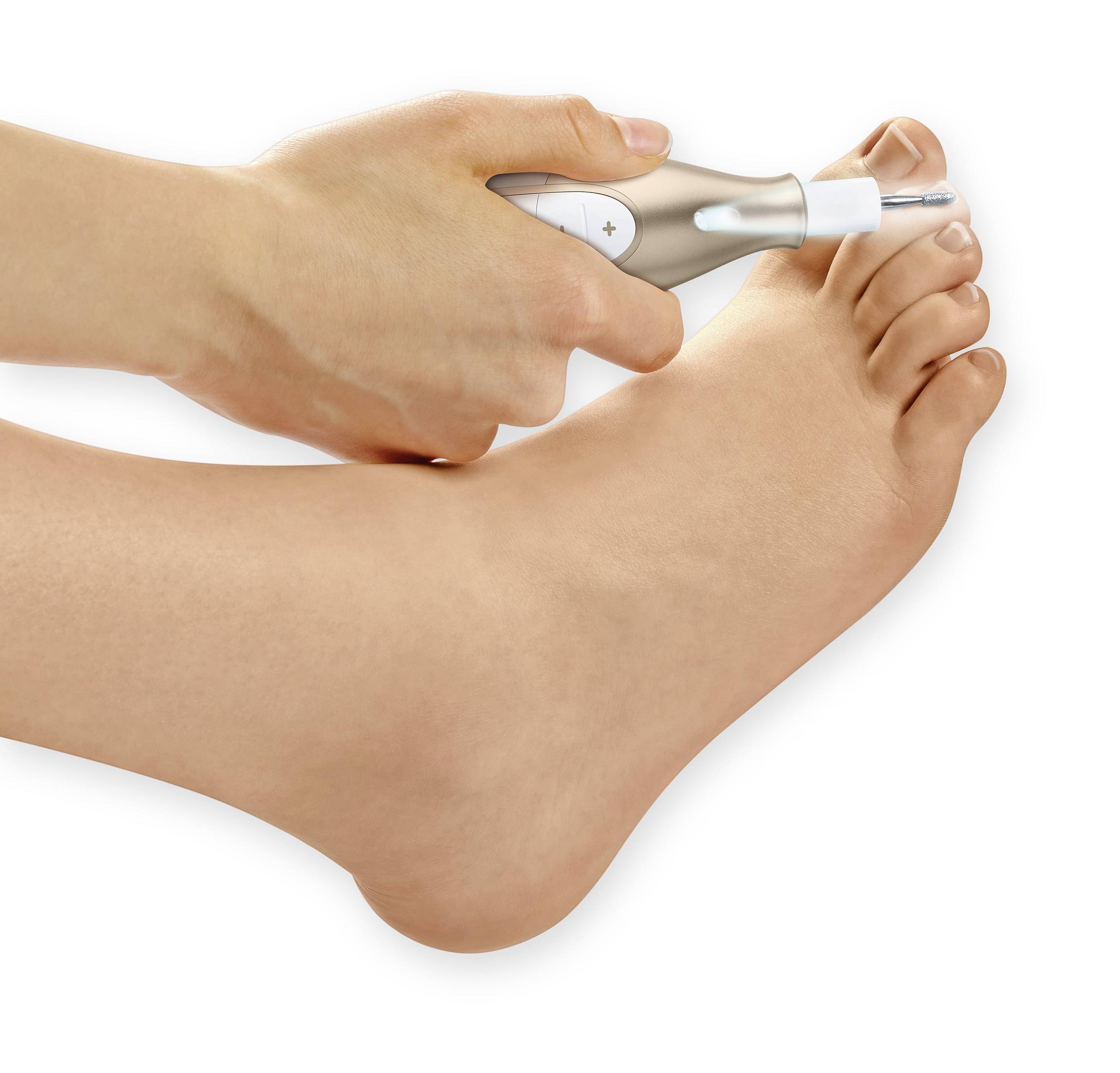 Jedna ręka trzyma elektryczne urządzenie do manicure i pedicure przy dużym palcu u nogi. Urządzenie posiada przyciski sterowania prędkością i kierunkiem.