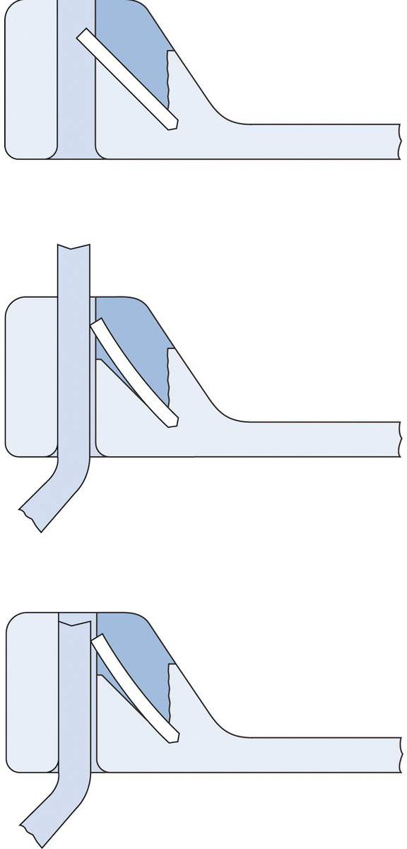 Trzy diagramy przedstawiają różne techniki cięcia pasów tkaniny. Górny: stożkowy; Środkowy: prosty; Dolny: pod kątem.