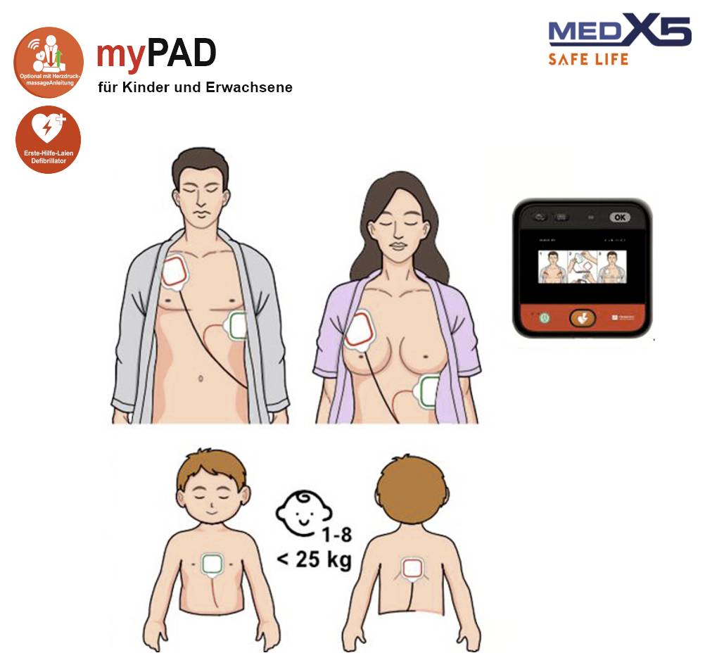 "Elektroder för kombinerad användning på vuxna och barn" diagram visar elektrodplacering på vuxna och barn för användning med defibrillatorer.