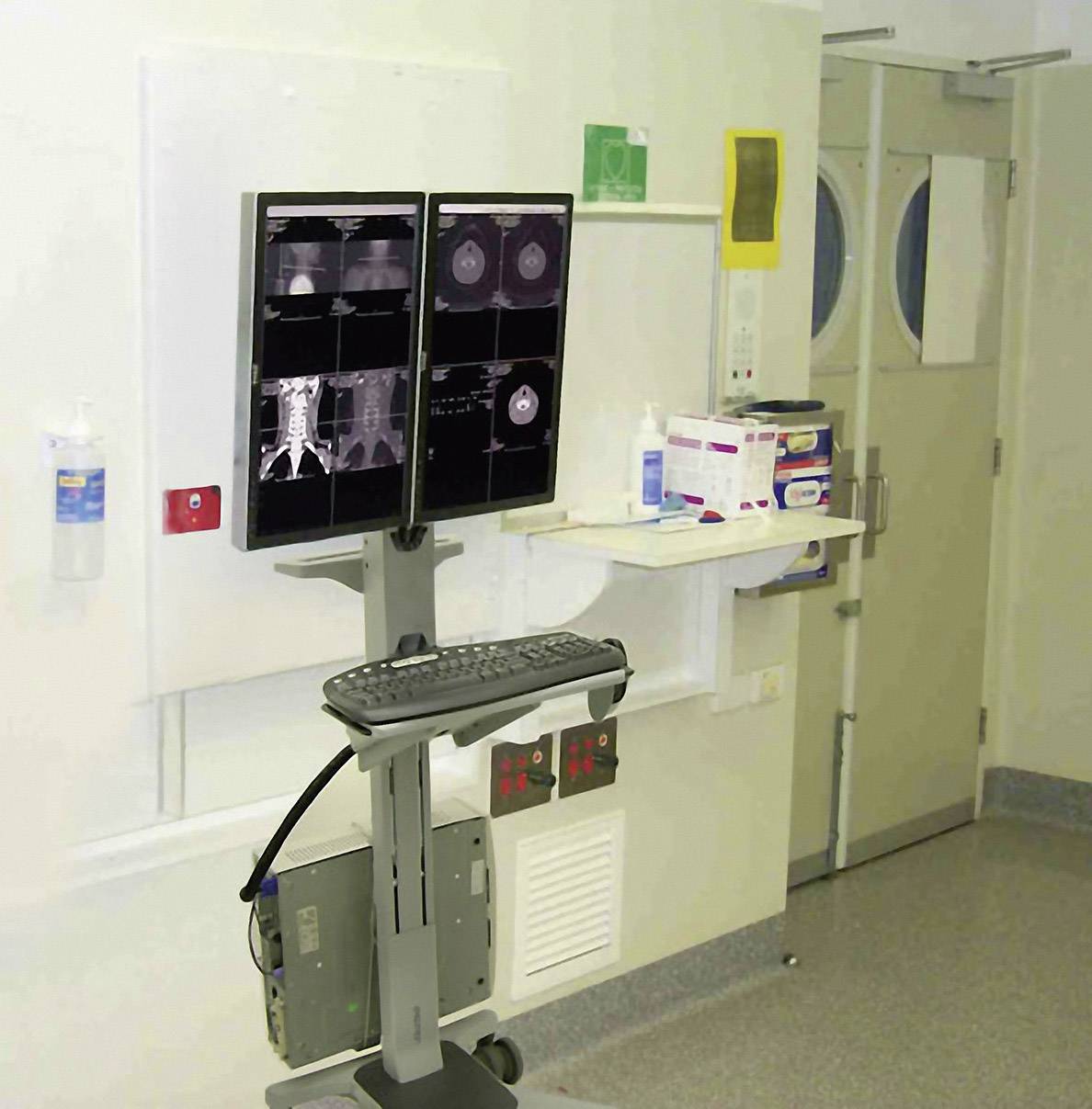 En medicinsk övervakningsvagn visar röntgenbilder på två skärmar i en sjukhusmiljö intill en vägg med medicinsk utrustning.