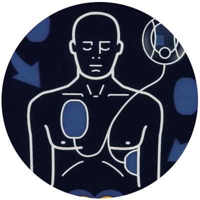 Schritt 1: Anbringen der Elektroden des Defibrillators