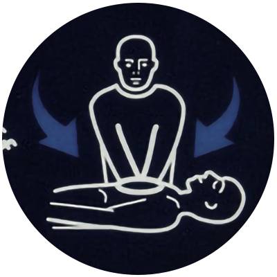 Schritt 3: Stromstoß durch Defi und anschließende Herzdruckmassage