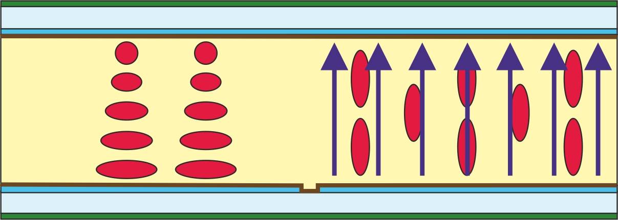 TN-Panel