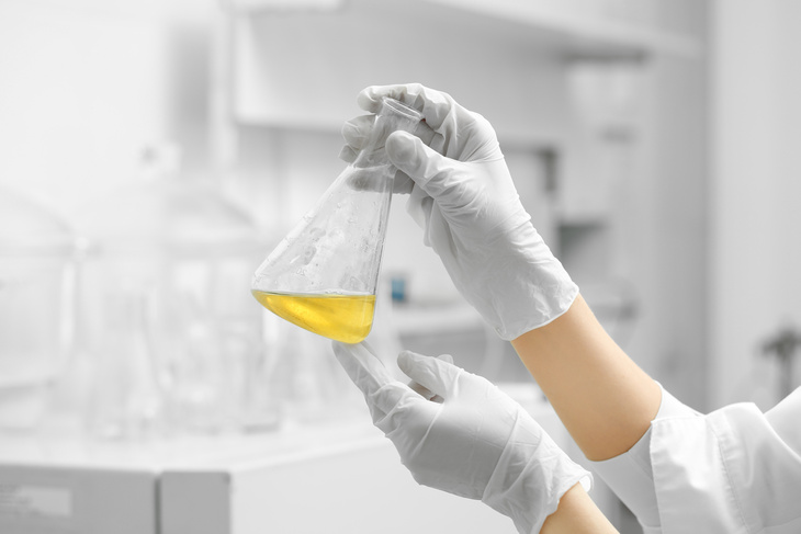 Une personne portant des gants blancs tient un ballon Erlenmeyer contenant un liquide jaune dans un laboratoire.